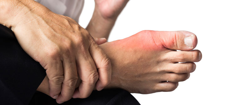 Arthritis Foot/Ankle