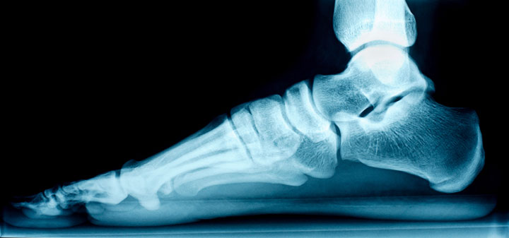Advanced Reconstructive Foot/Ankle Surgery